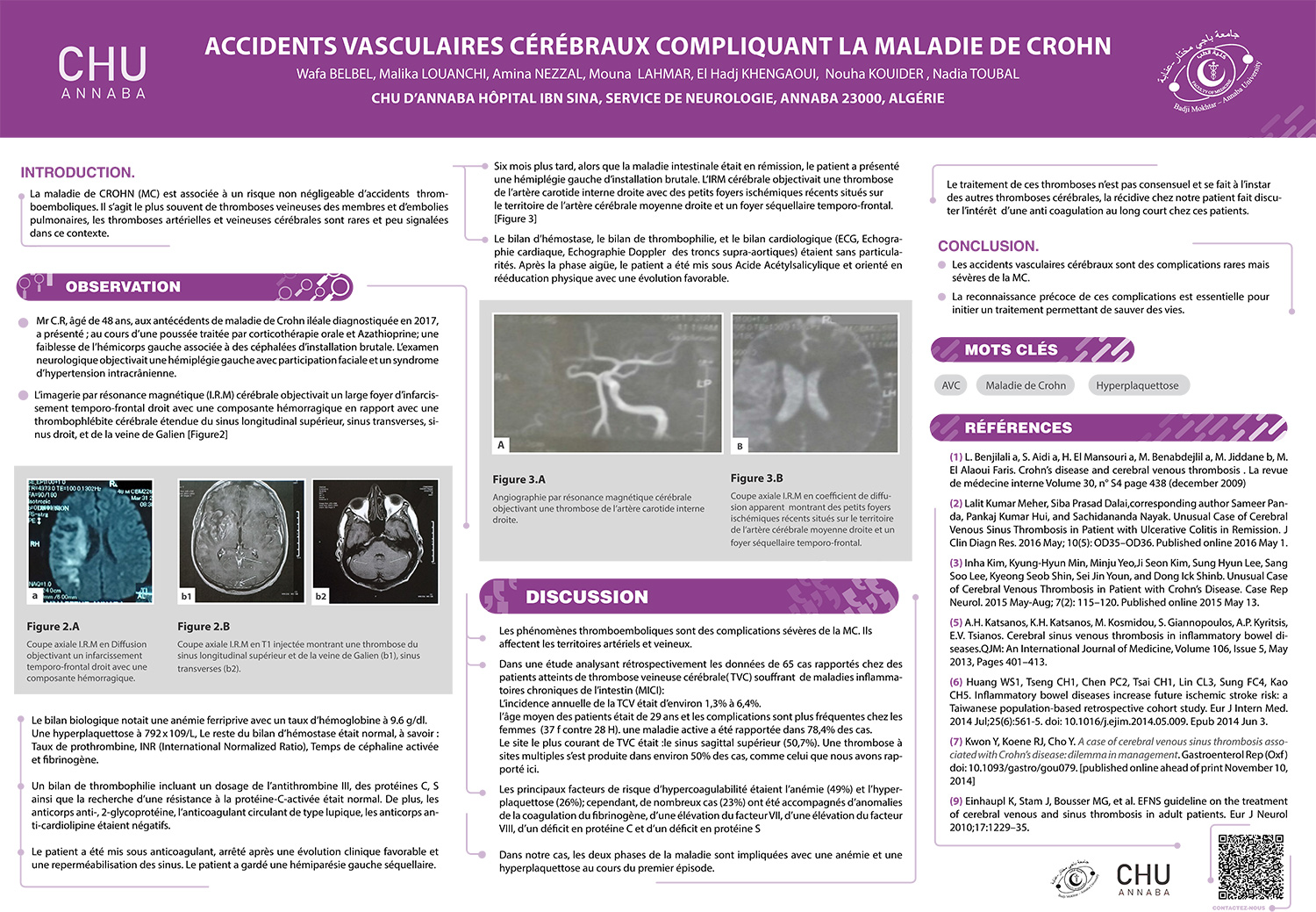 ACCIDENTS VASCULAIRES CÉRÉBRAUX COMPLIQUANT LA MALADIE DE CROHN