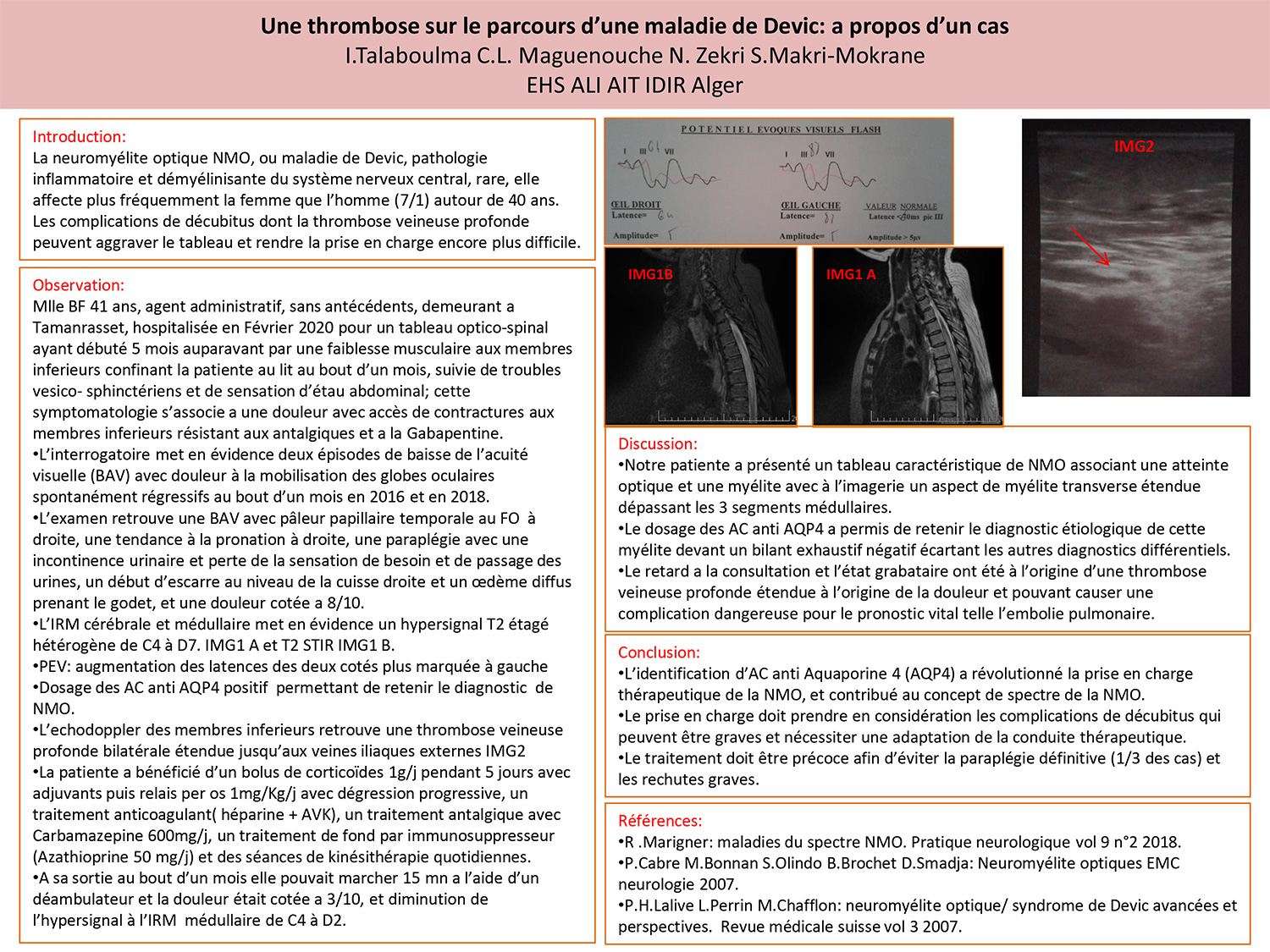 Une thrombose sur le parcours d’une maladie de Devic: a propos d’un cas