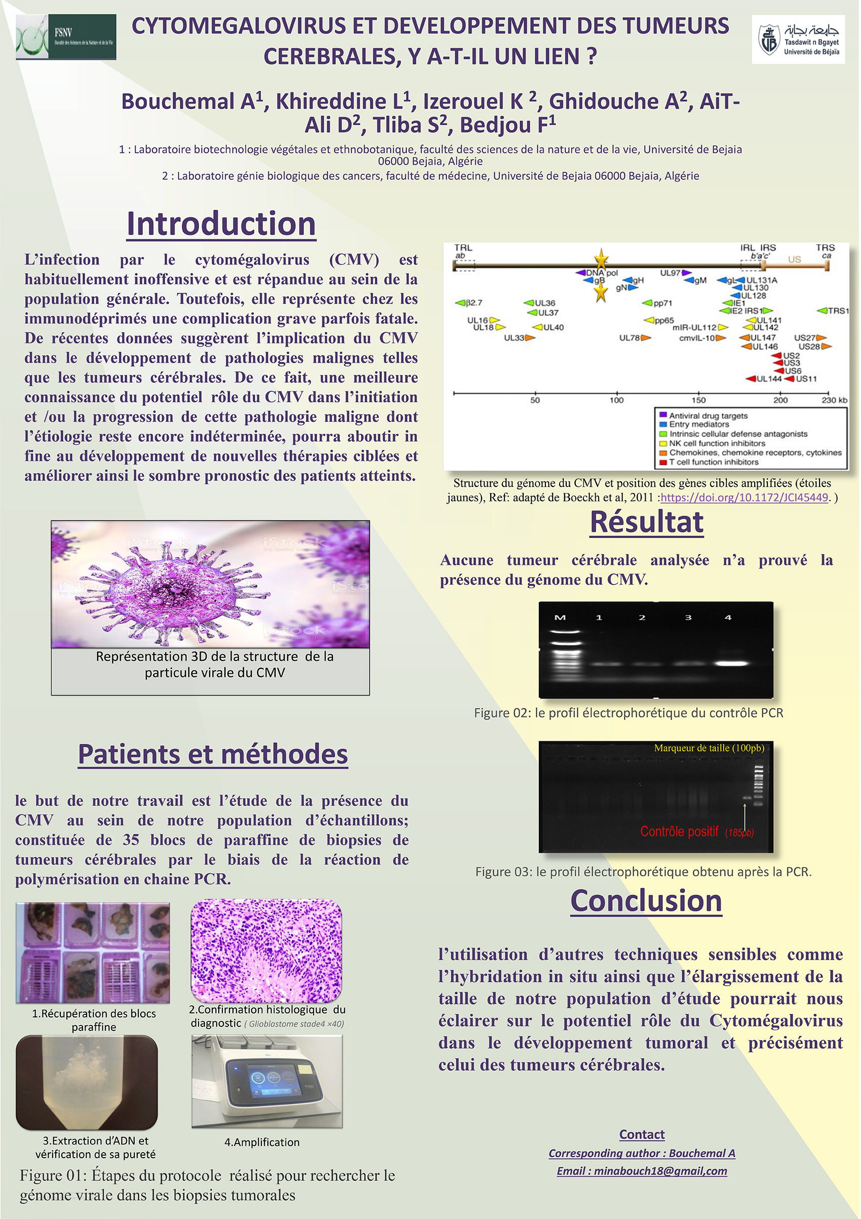 P51 : CYTOMEGALOVIRUS ET DEVELOPPEMENT DES TUMEURS CEREBRALES, Y A-T-IL UN LIEN ?
