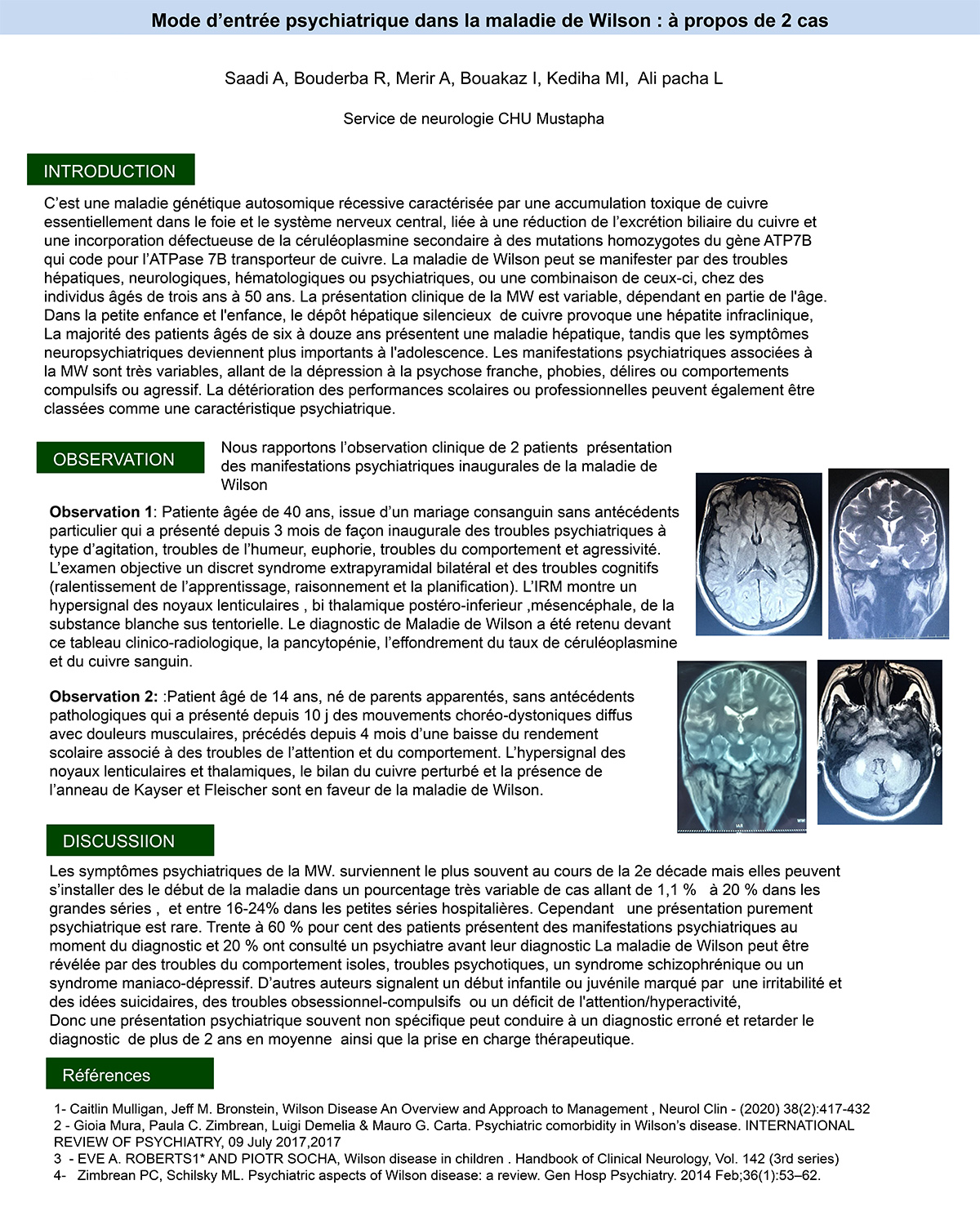 Mode d’entrée psychiatrique dans la maladie de Wilson : à propos 2 cas