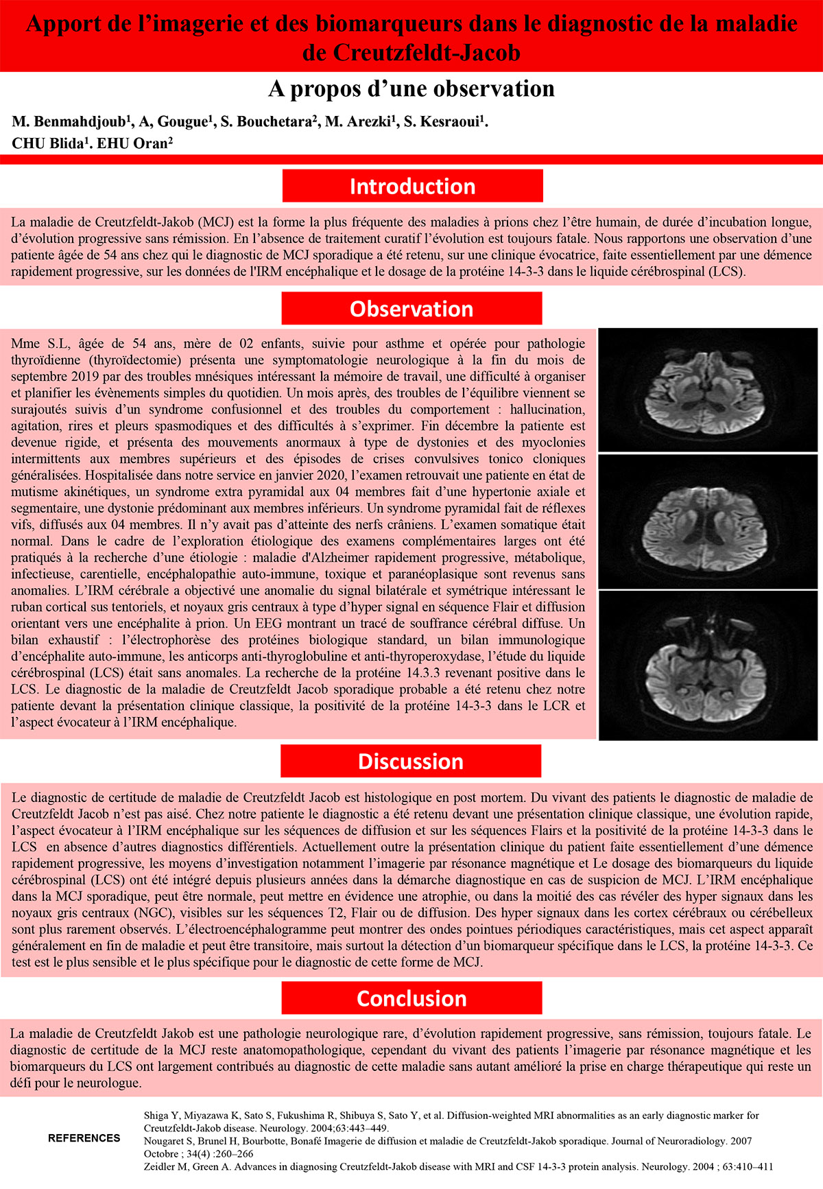 Apport de l’imagerie et des biomarqueurs dans le diagnostic de la maladie de Creutzfeldt-Jacob : A propos d’une observation