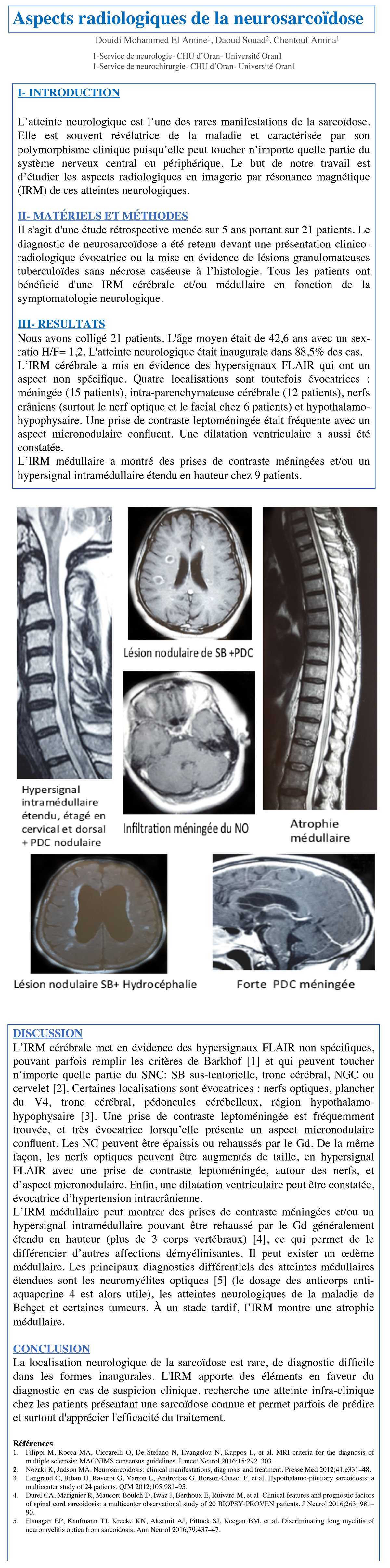Aspects radiologiques de la neurosarcoïdose