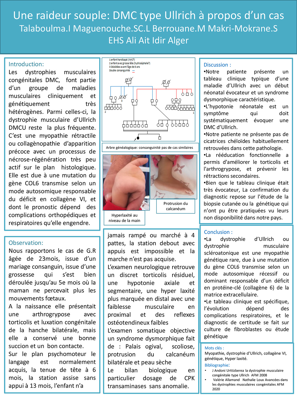 Une raideur souple: DMC type Ullrich à propos d’un cas