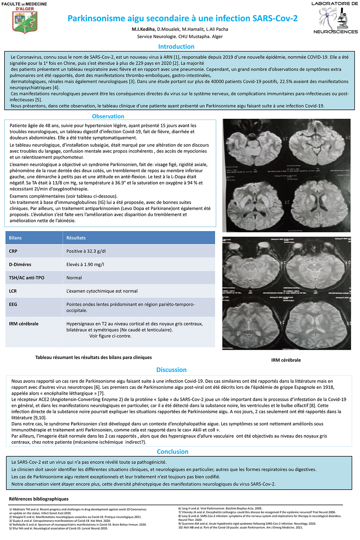 Parkinsonisme aigu secondaire à une infection SARS-Cov-2