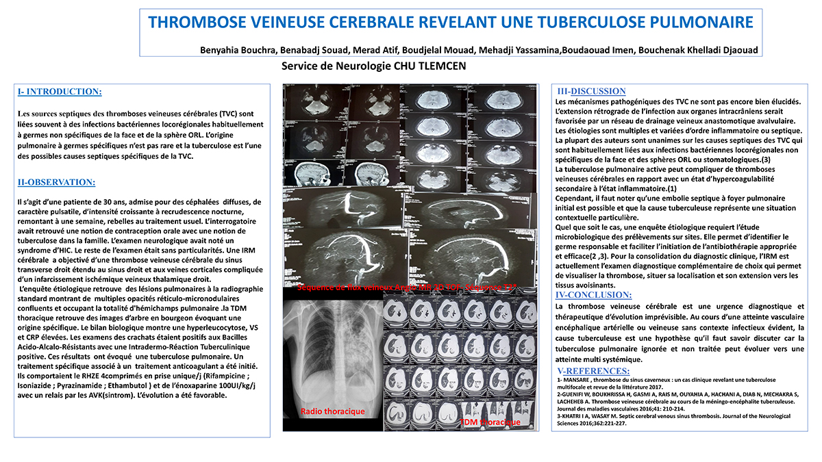 THROMBOSE VEINEUSE CEREBRALE REVELANT UNE TUBERCULOSE PULMONAIRE