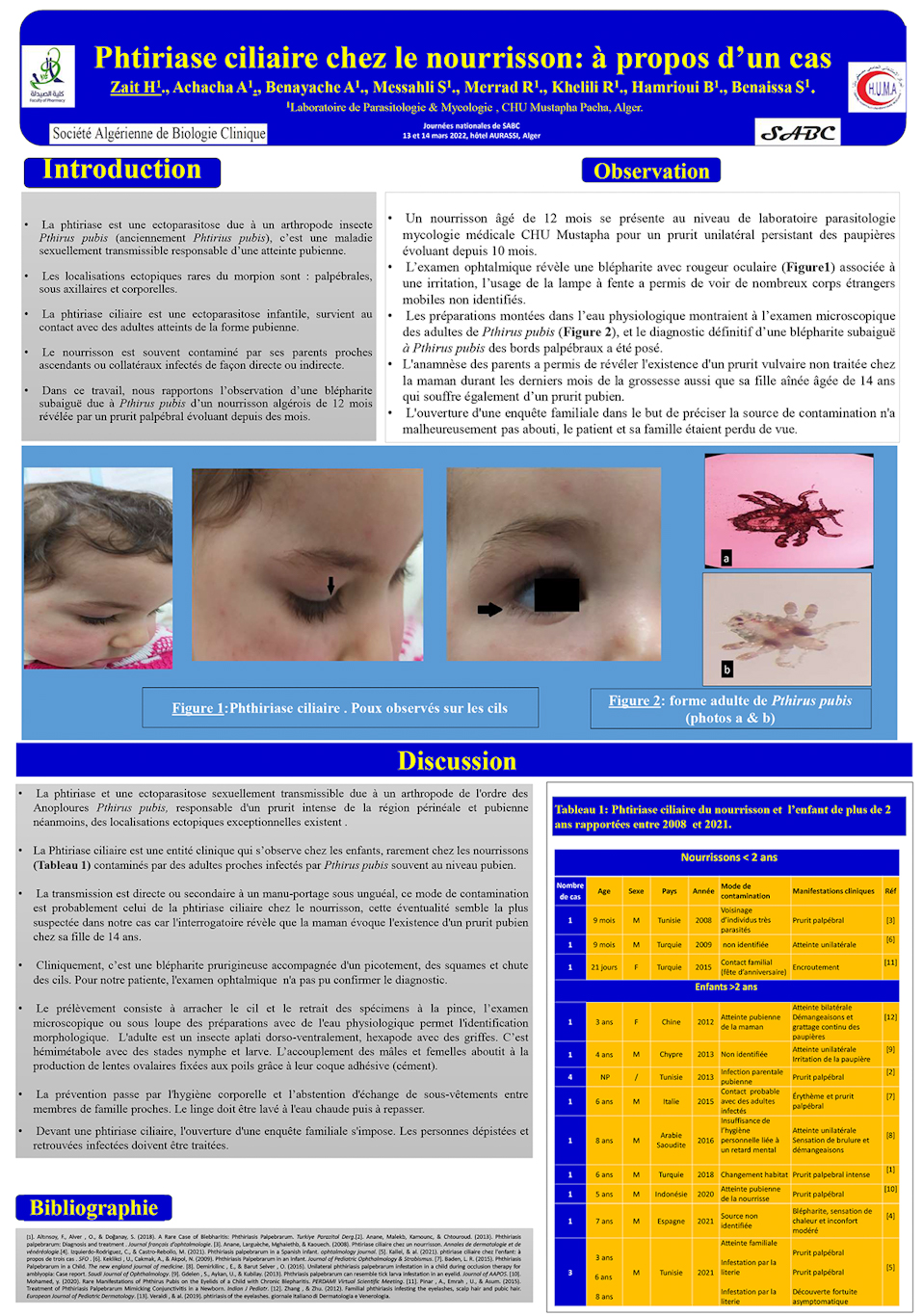 P29: Phtiriase ciliaire chez le nourrisson: à propos d’un cas