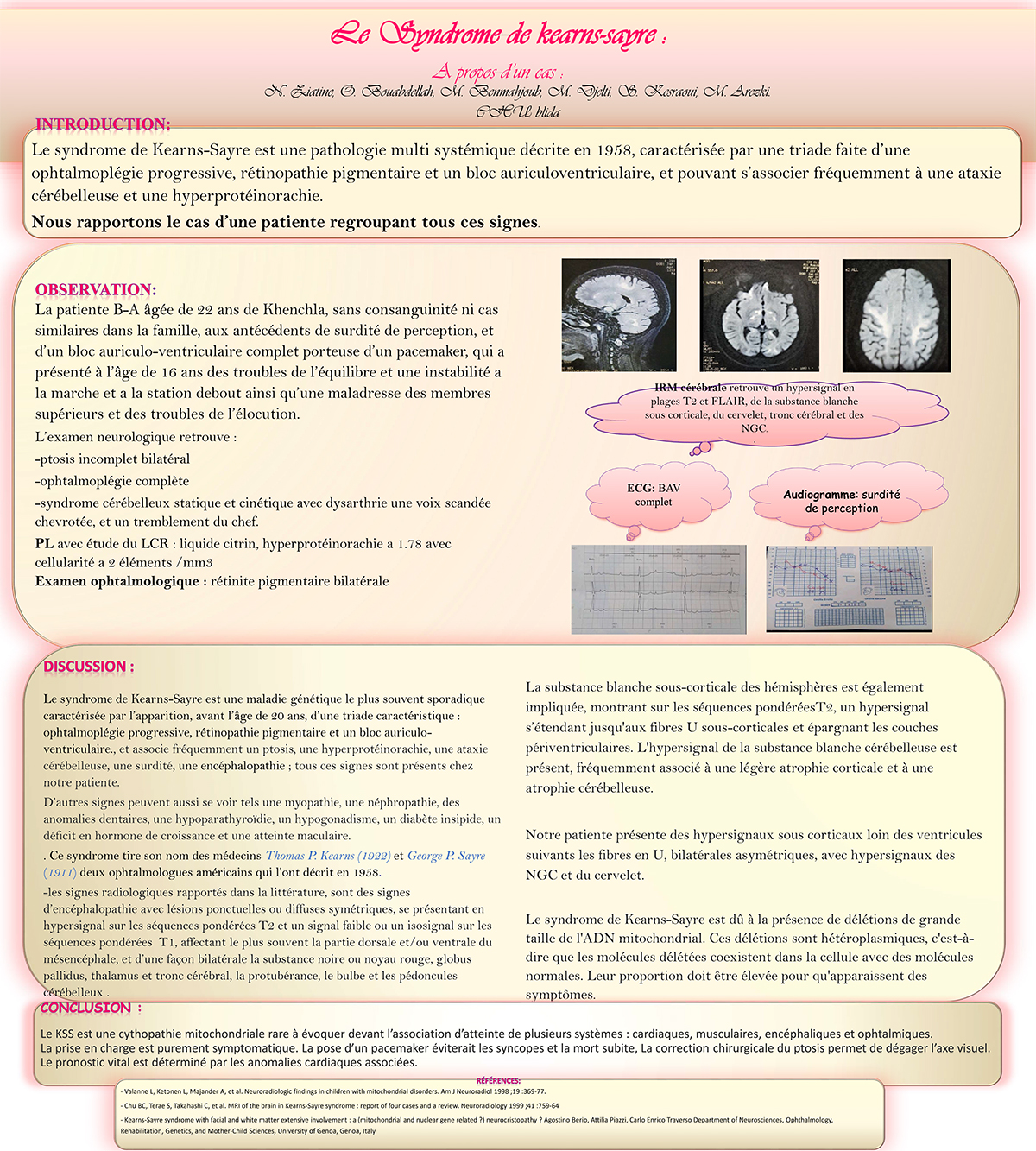 NV-15 Le Syndrome de KEARNS SAYRE