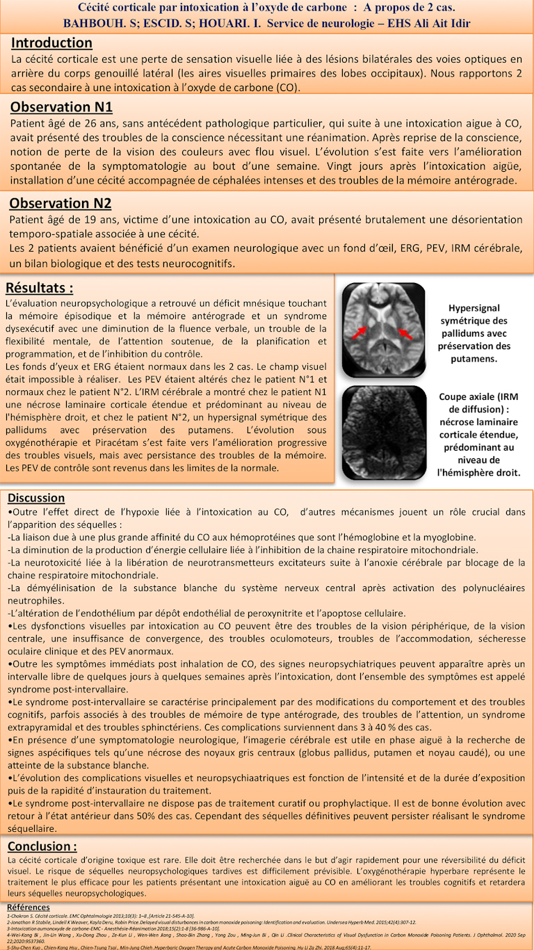 NV-25 Cécité corticale par intoxication à l’oxyde de carbone. A propos de 2 cas.