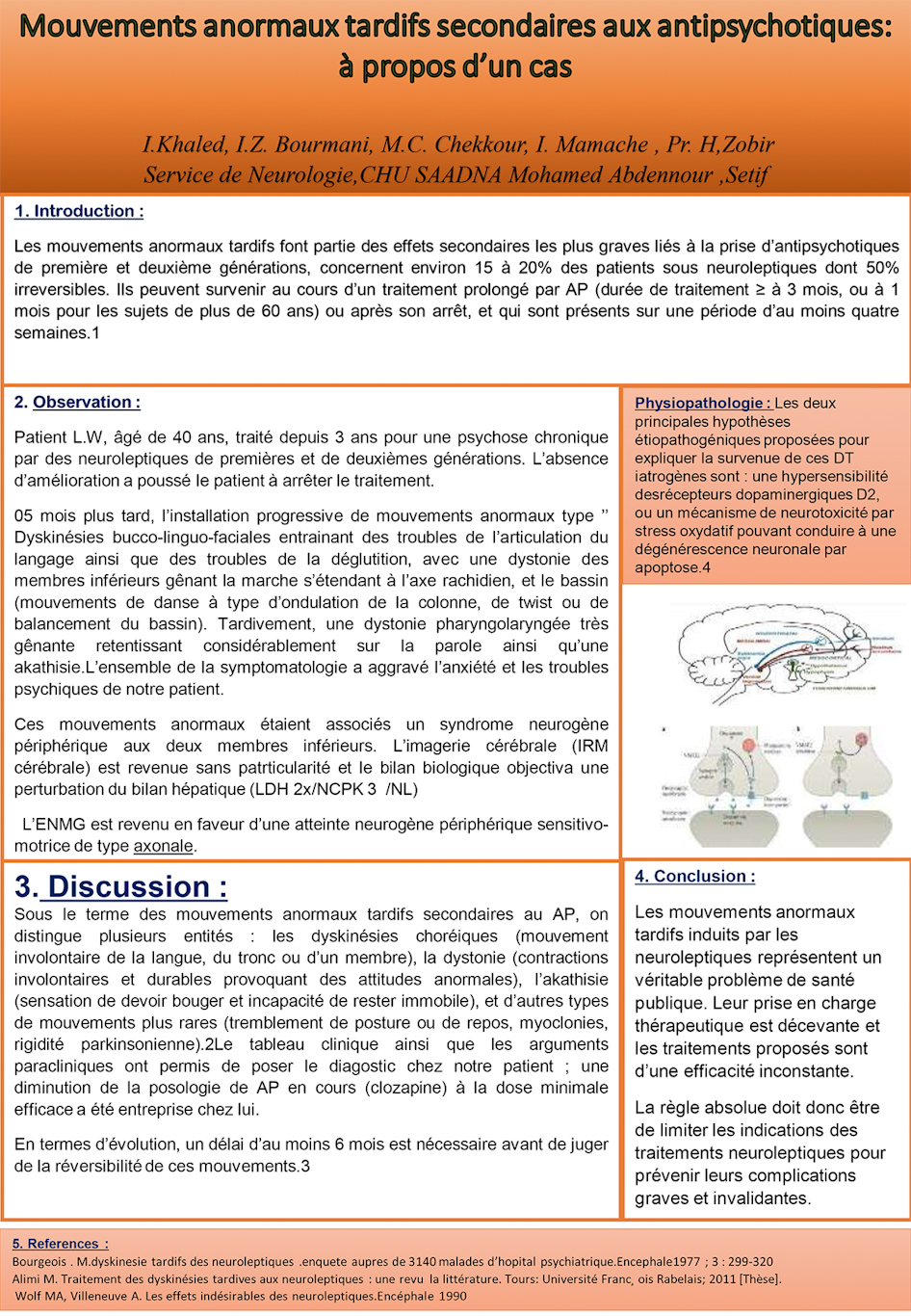 NV-29 Mouvements anormaux tardifs induits par les antipsychotiques.