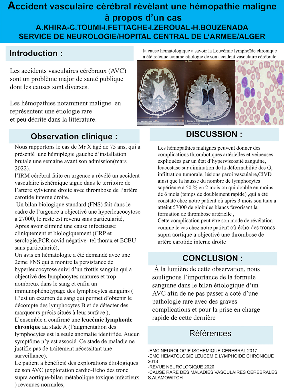 NV-37 Accident vasculaire cérébral révélant une hémopathie maligne, À propos d’un cas.