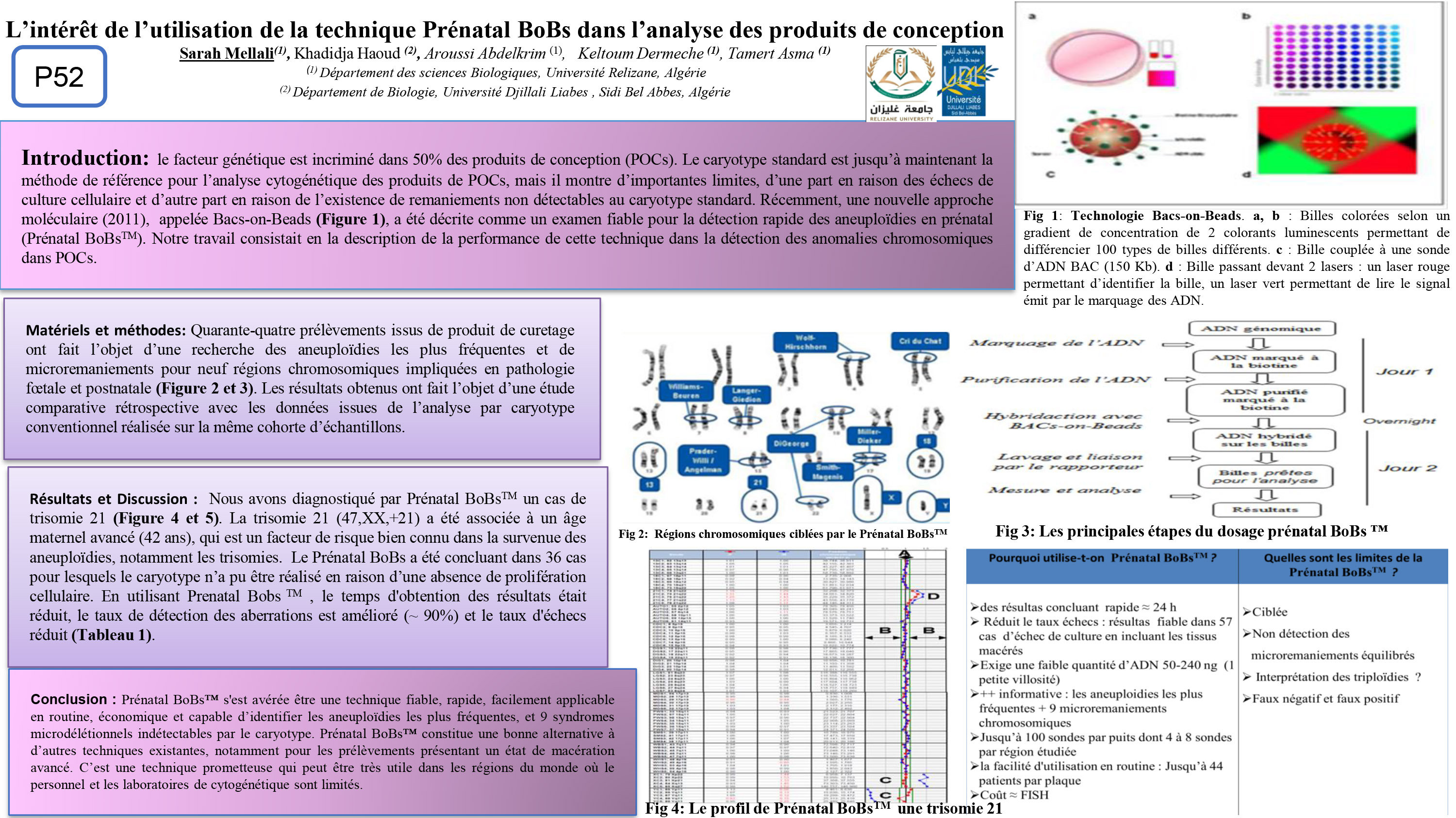 GENETIQUE : P52 - L’intérêt de l’utilisation de la technique Prénatal BoBs dans l’analyse des produits de conception