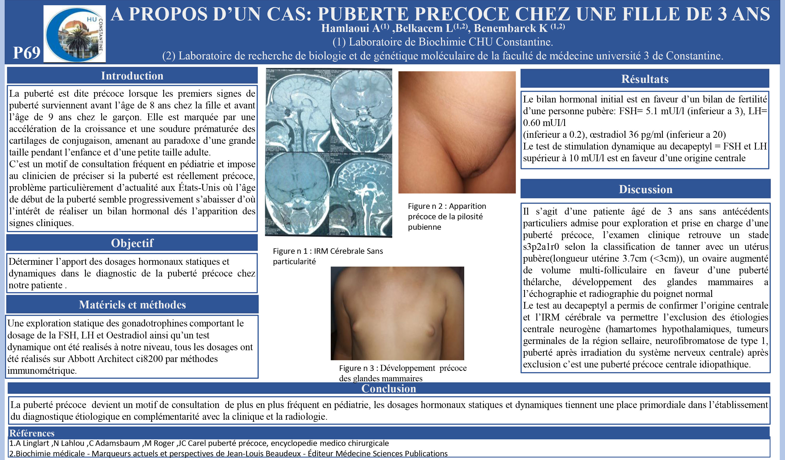 SANTE DE LA FEMME : P69- A PROPOS D’UN CAS: PUBERTE PRECOCE CHEZ UNE FILLE DE 3 ANS