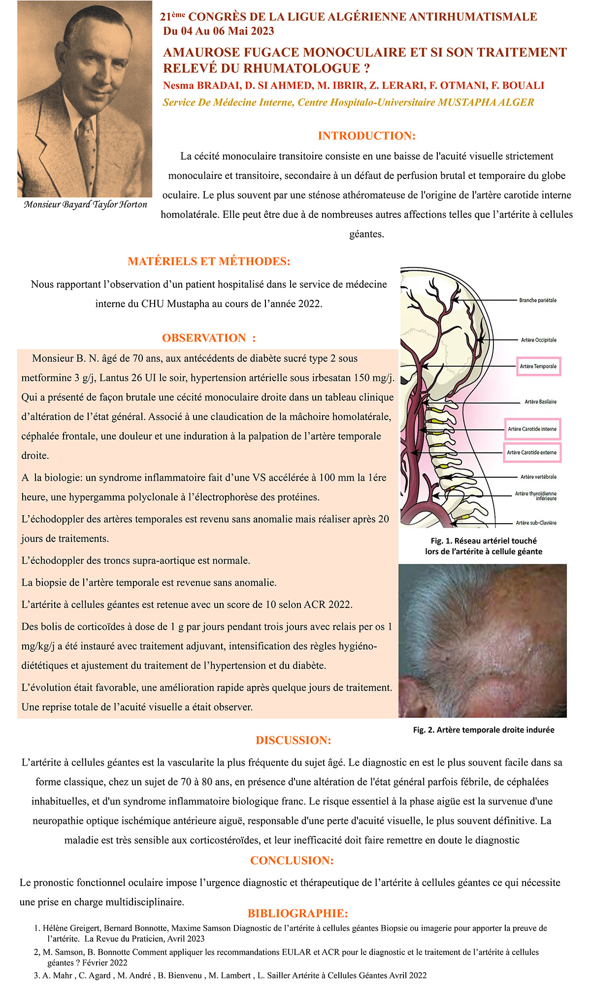 AMAUROSE FUGACE MONOCULAIRE ET SI SON TRAITEMENT  RELEVÉ DU RHUMATOLOGUE ?