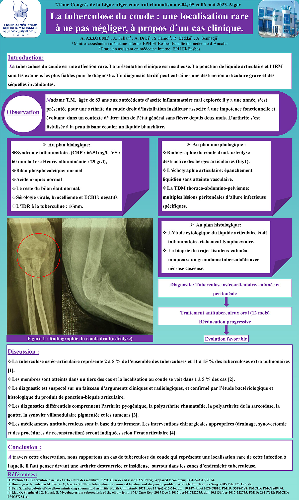 La tuberculose du coude : une localisation rare  à ne pas négliger, à propos d’un cas clinique.