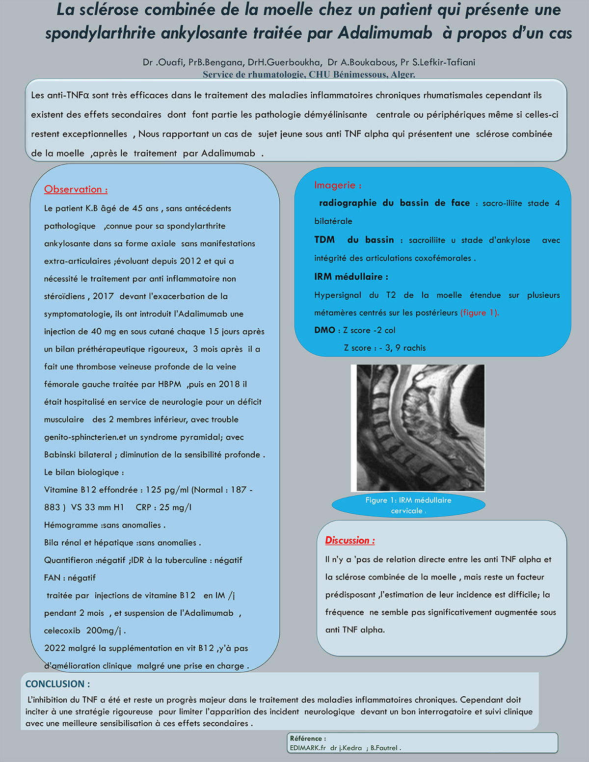 La sclérose combinée de la moelle chez un patient qui présente une  spondylarthrite ankylosante traitée par Adalimumab à propos d’un cas