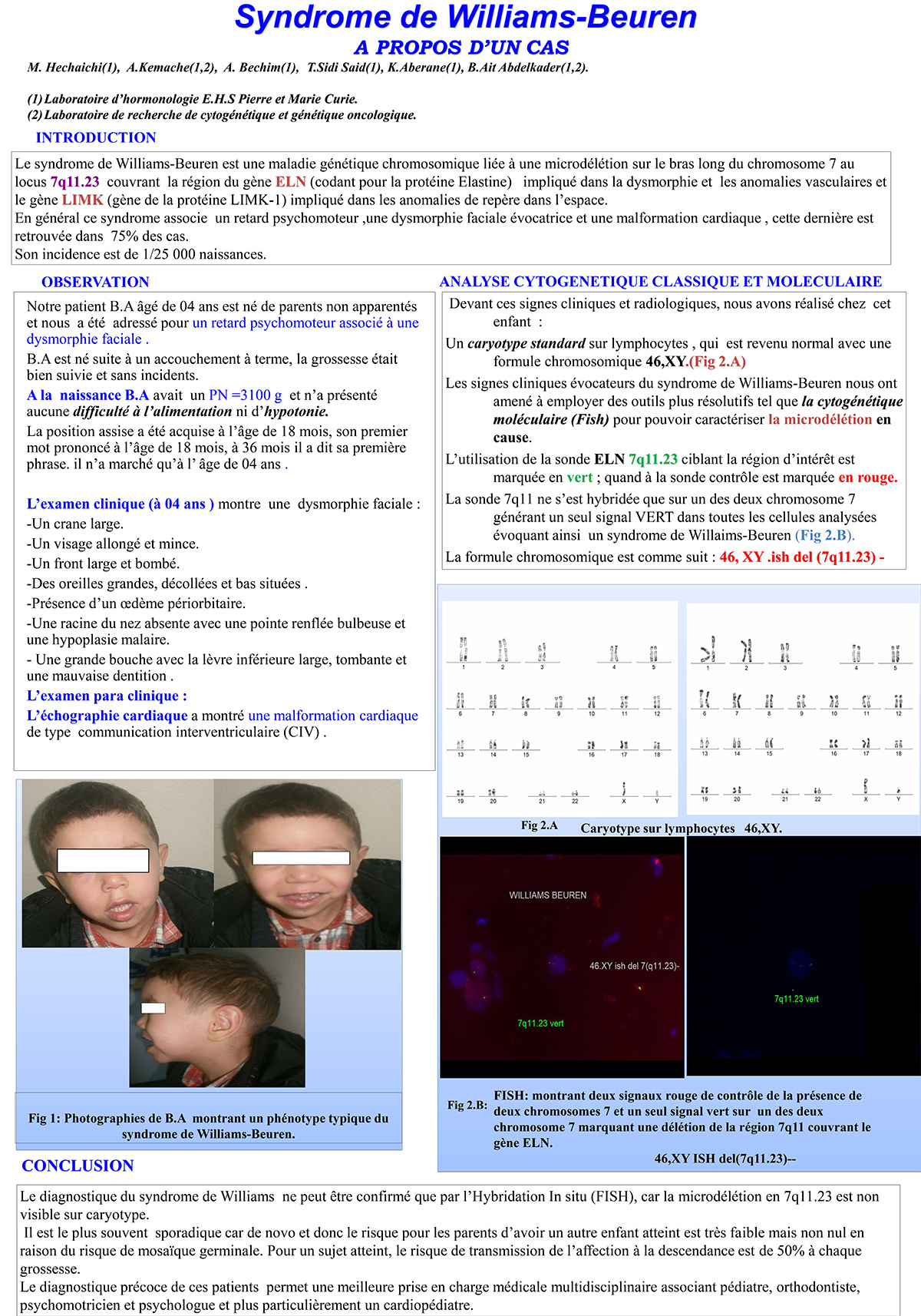 P12 : Syndrome de Williams-Beuren A PROPOS D’UN CAS