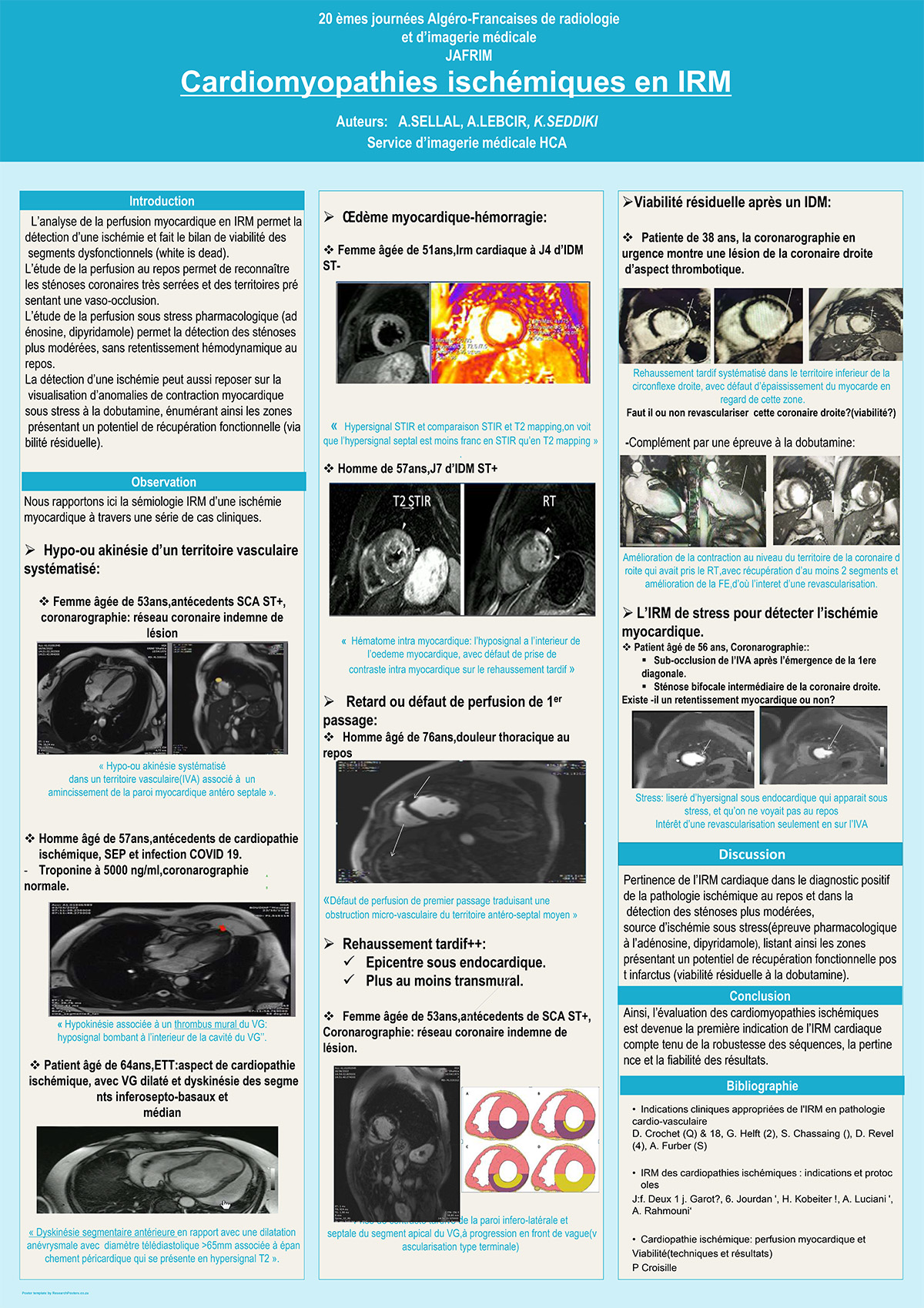 Cardiomyopathies ischémiques en IRM