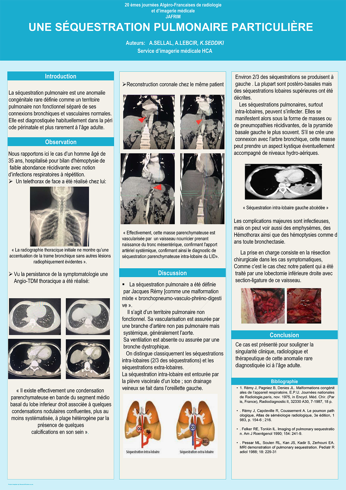 UNE SÉQUESTRATION PULMONAIRE PARTICULIÈRE